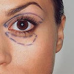 eyelid
